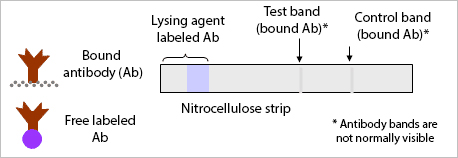 How a malaria rapid diagnostic test works (1)